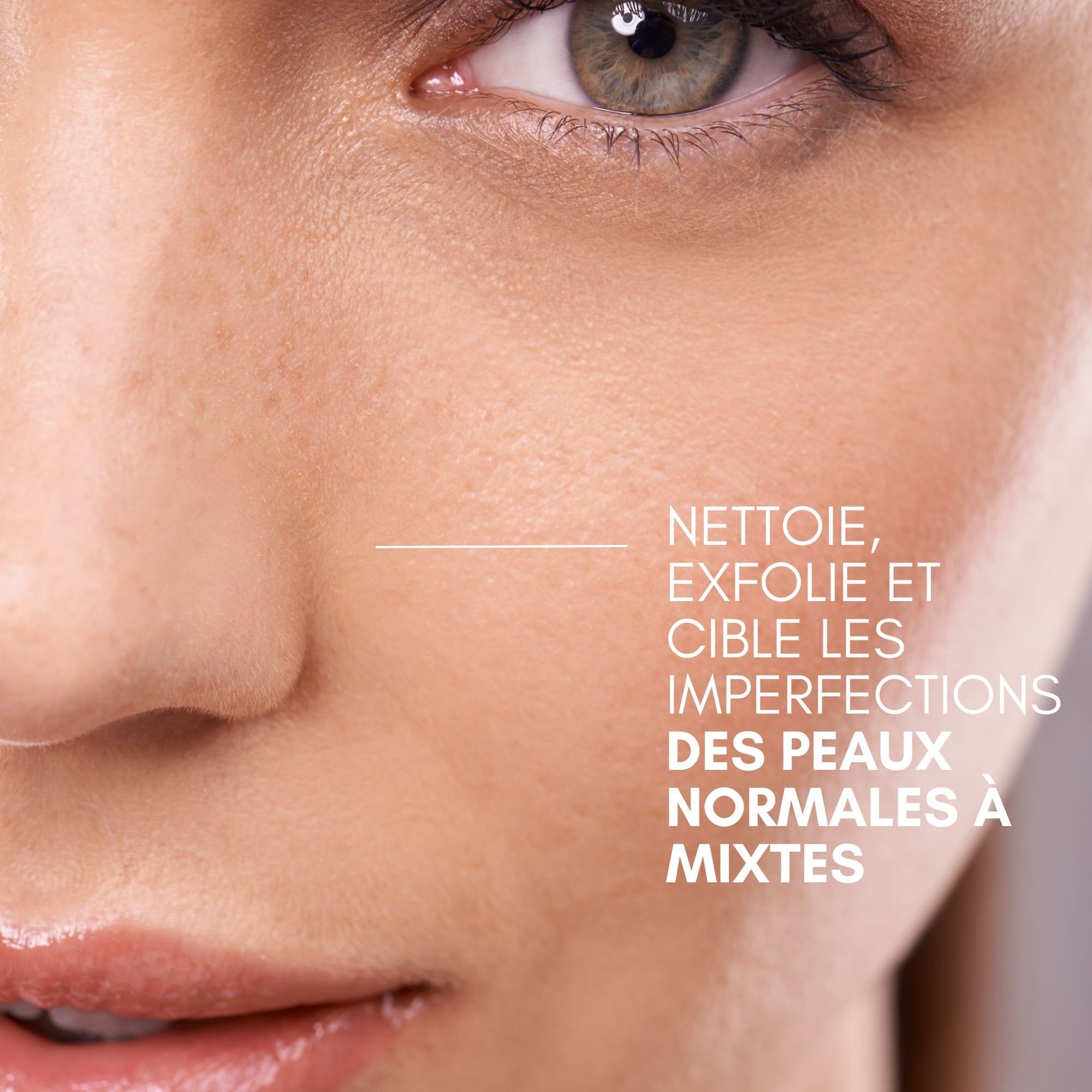 Kit no Spot Peaux normales à mixtes bénéfices-Image1