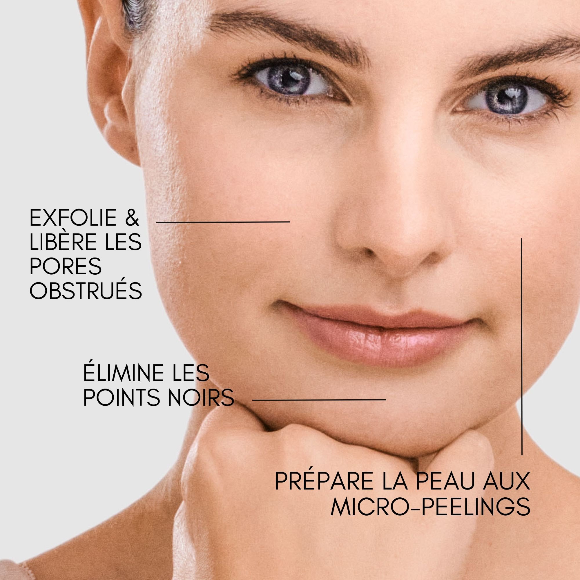 Enoliss Perfect Skin Peel 5 AHA bénéfices pour la peau-Image2