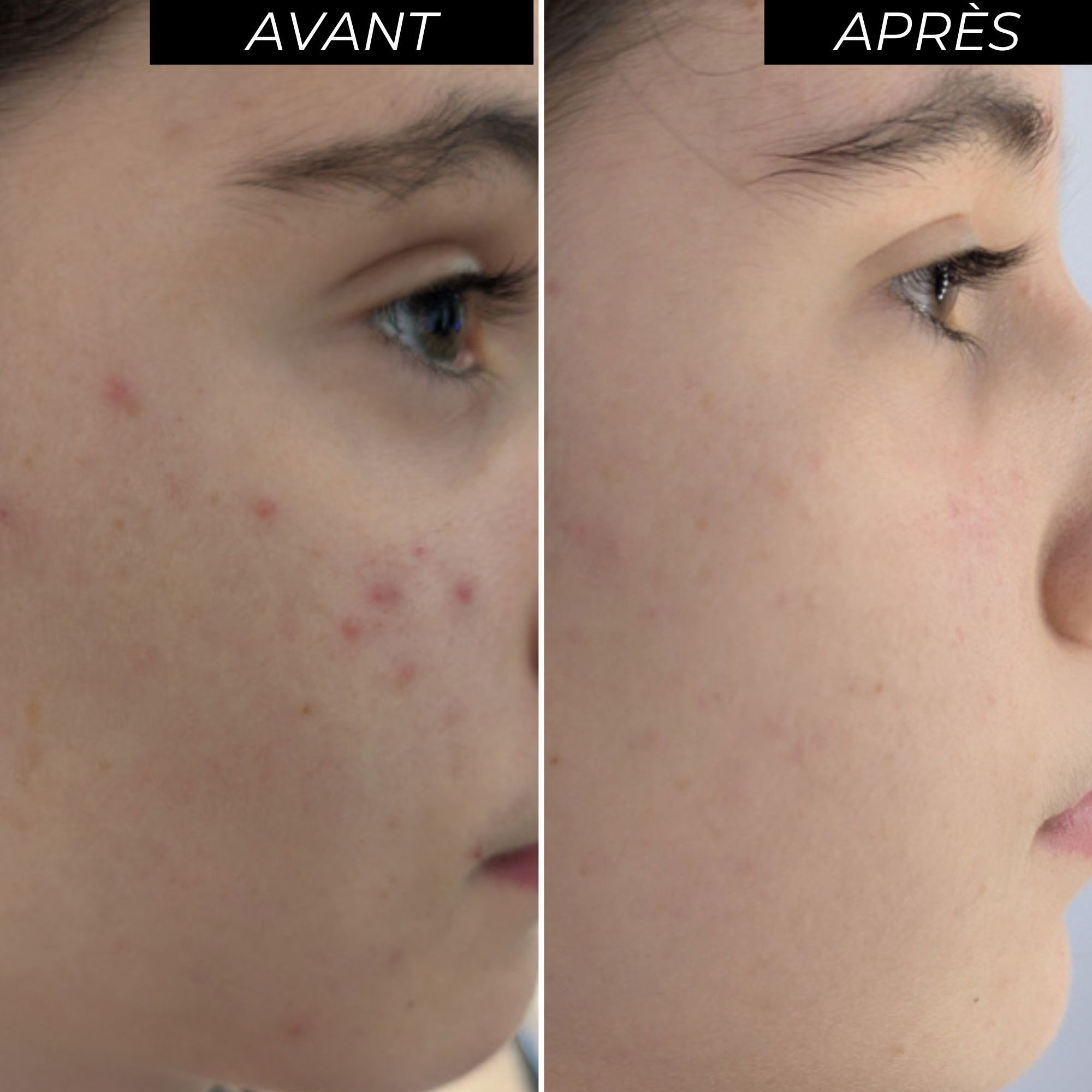 Coffret peeling éclat avant/après-Image3