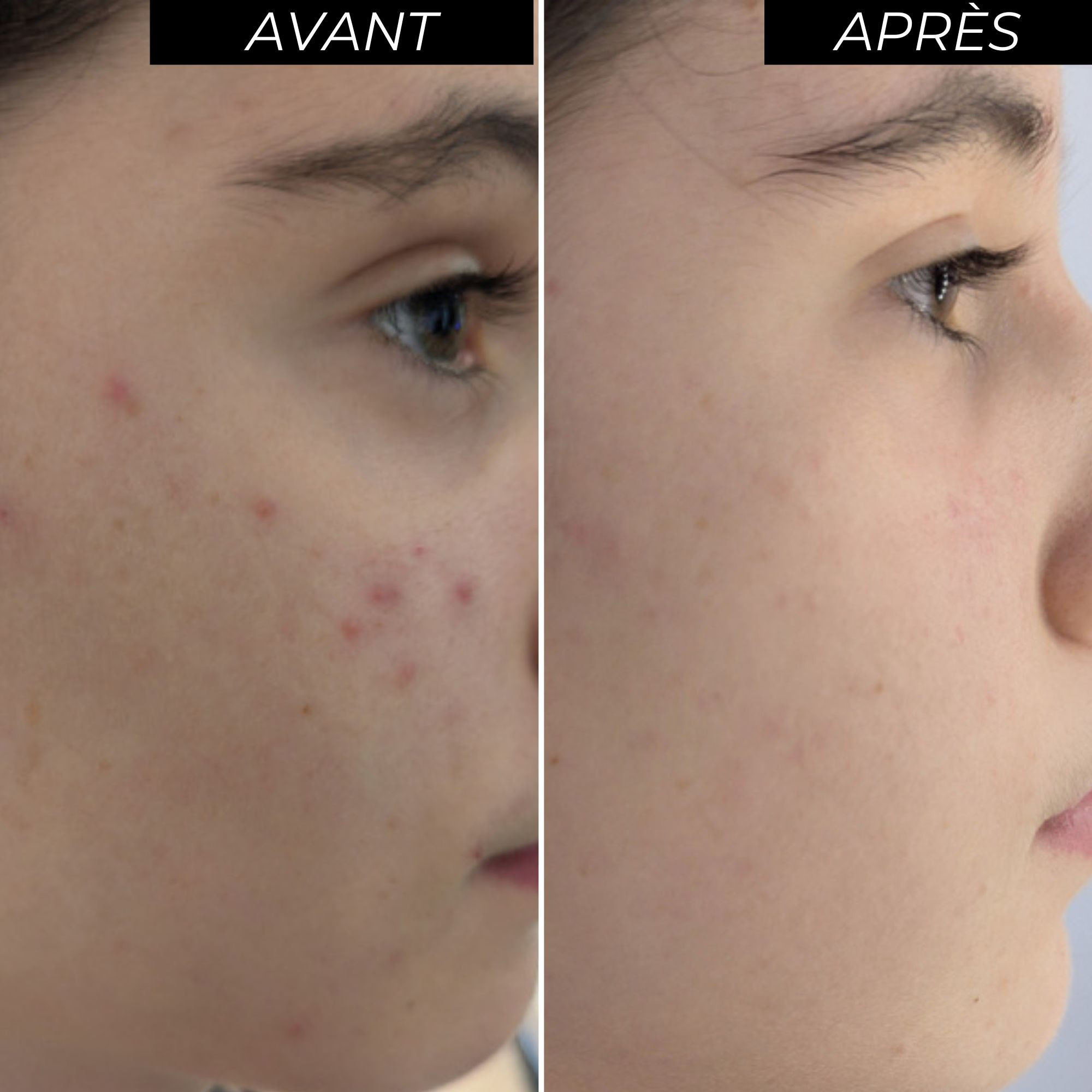 Coffret peeling éclat avant/après-Image3