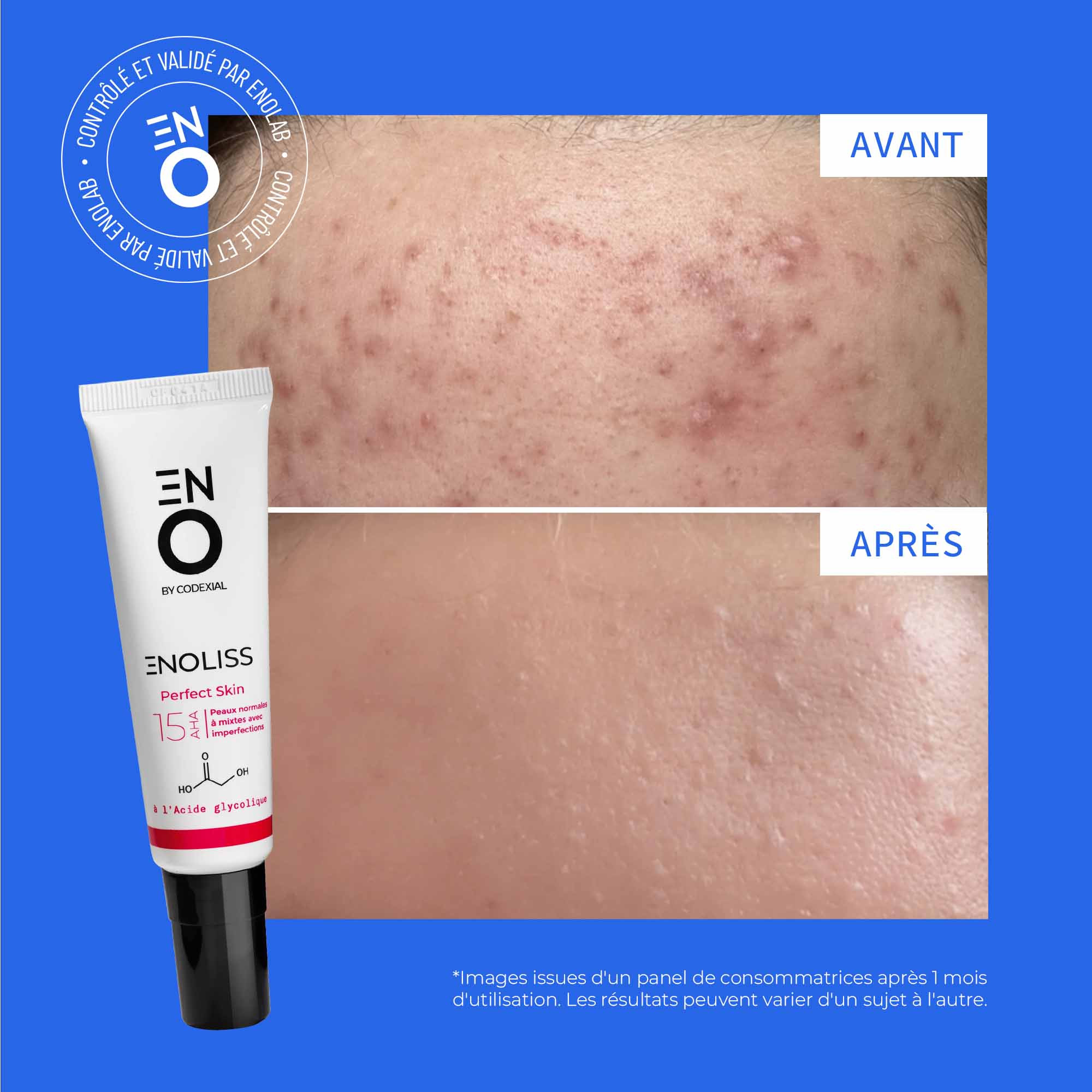 Photos Avant / après résultats-Image8